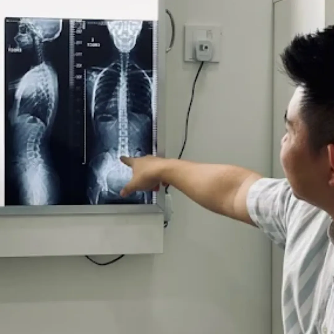 Chiropractor analyzing a spinal X-ray